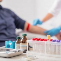 Blood test for Alzheimer's disease: pros and cons Blood test for Alzheimer's disease: pros and cons